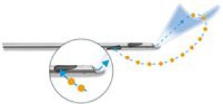 Le Body-Jet® : un concept de liposuccion innovant basé sur la méthode WAL