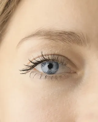 Chirurgie des paupières inférieures