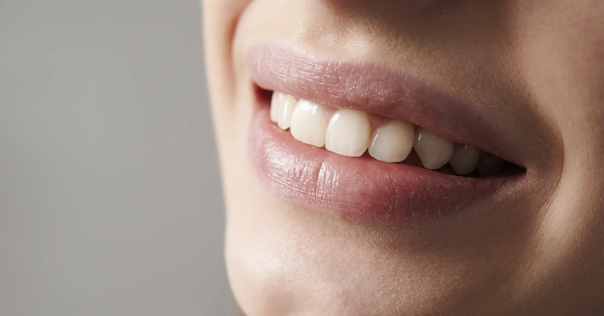 Injections d'acide hyaluronique pour redessiner la bouche
