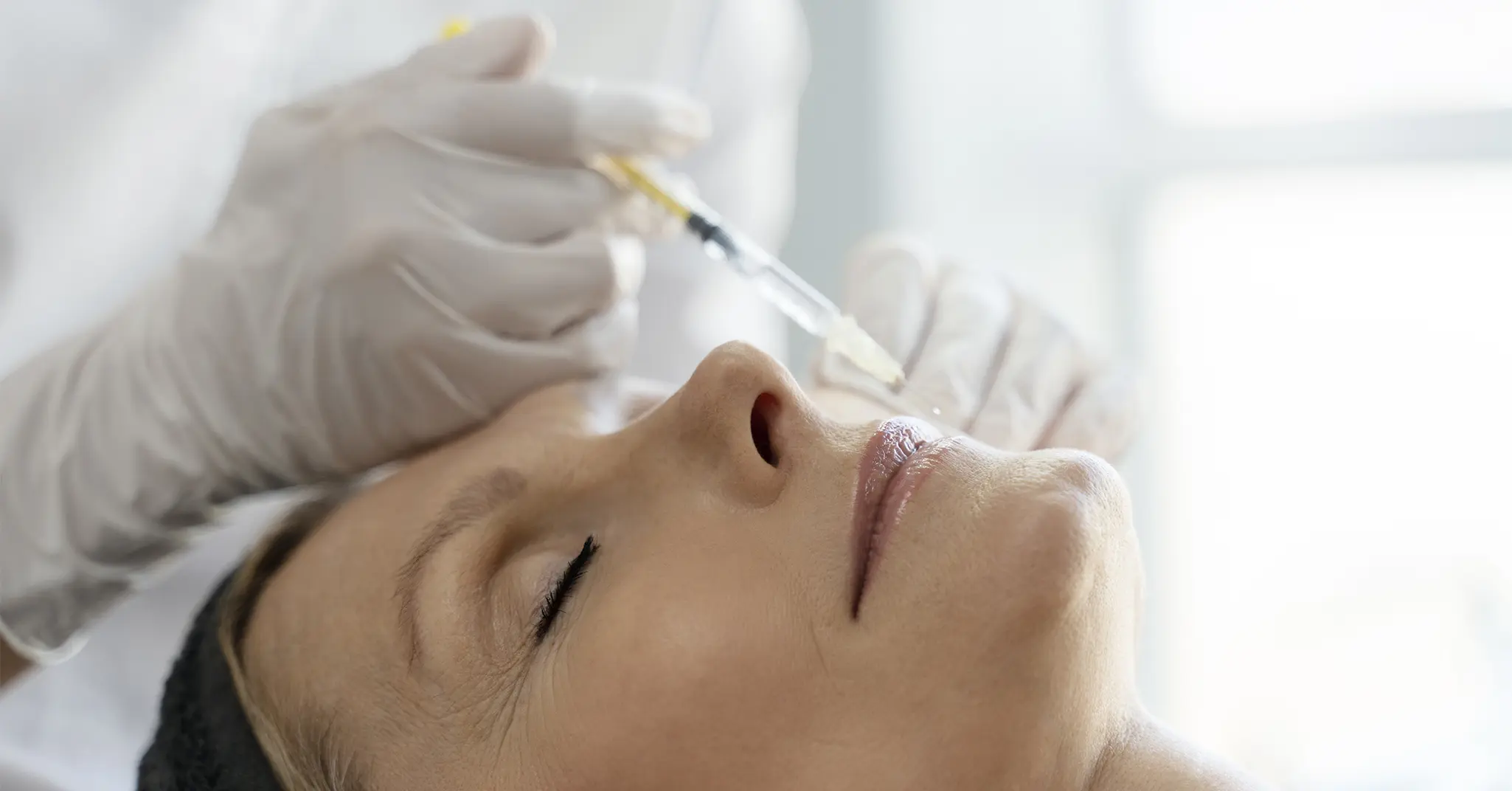Traitement des plis d'amertume par injection d'acide hyaluronique