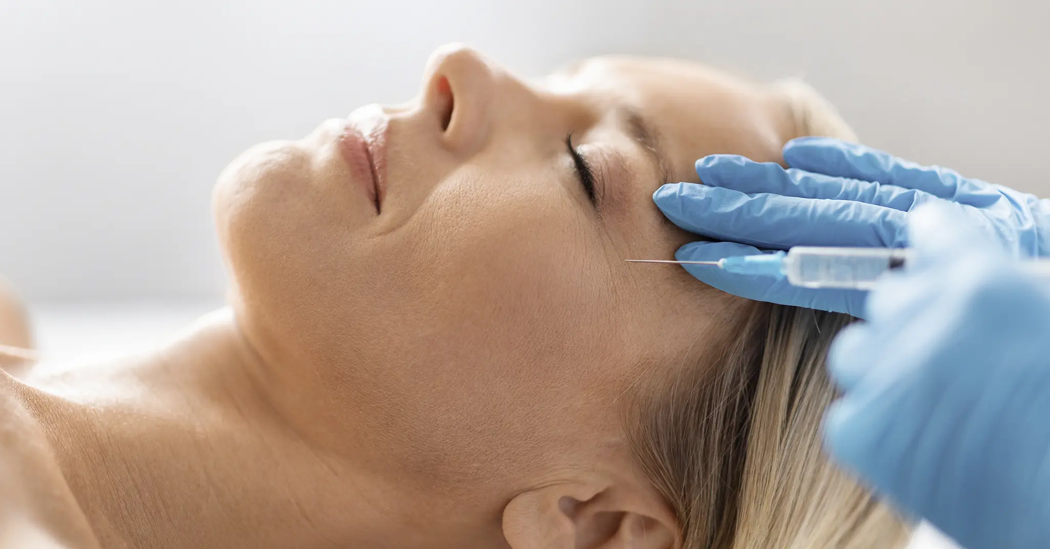 Injections de toxine botulique pour traiter les rides de la patte d'oie